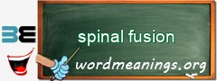 WordMeaning blackboard for spinal fusion